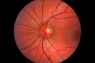 Zrakový nerv – důležitý optický kabel