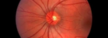 Zrakový nerv – důležitý optický kabel