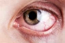 S poraněným okem jděte raději k lékaři
